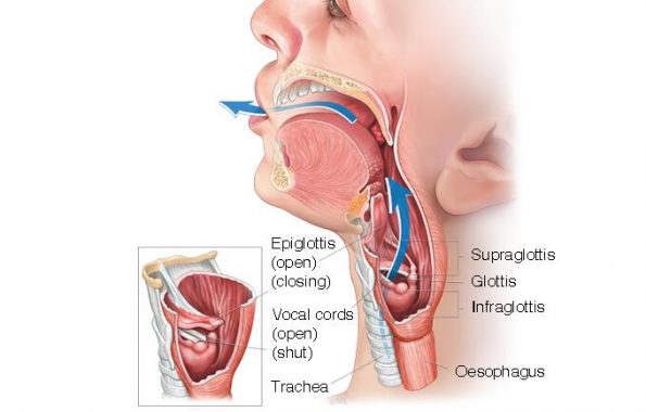 喉癌：原因、症状和治疗插图